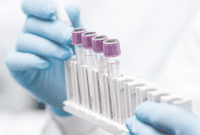 Divisi R&D CHEK menjadi tulang punggung inovasi produk diagnostik yang memperkuat margin laba perusahaan. (Dok. diastika.co.id)

