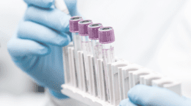 Divisi R&D CHEK menjadi tulang punggung inovasi produk diagnostik yang memperkuat margin laba perusahaan. (Dok. diastika.co.id)

