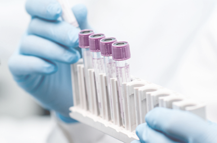 Divisi R&D CHEK menjadi tulang punggung inovasi produk diagnostik yang memperkuat margin laba perusahaan. (Dok. diastika.co.id)